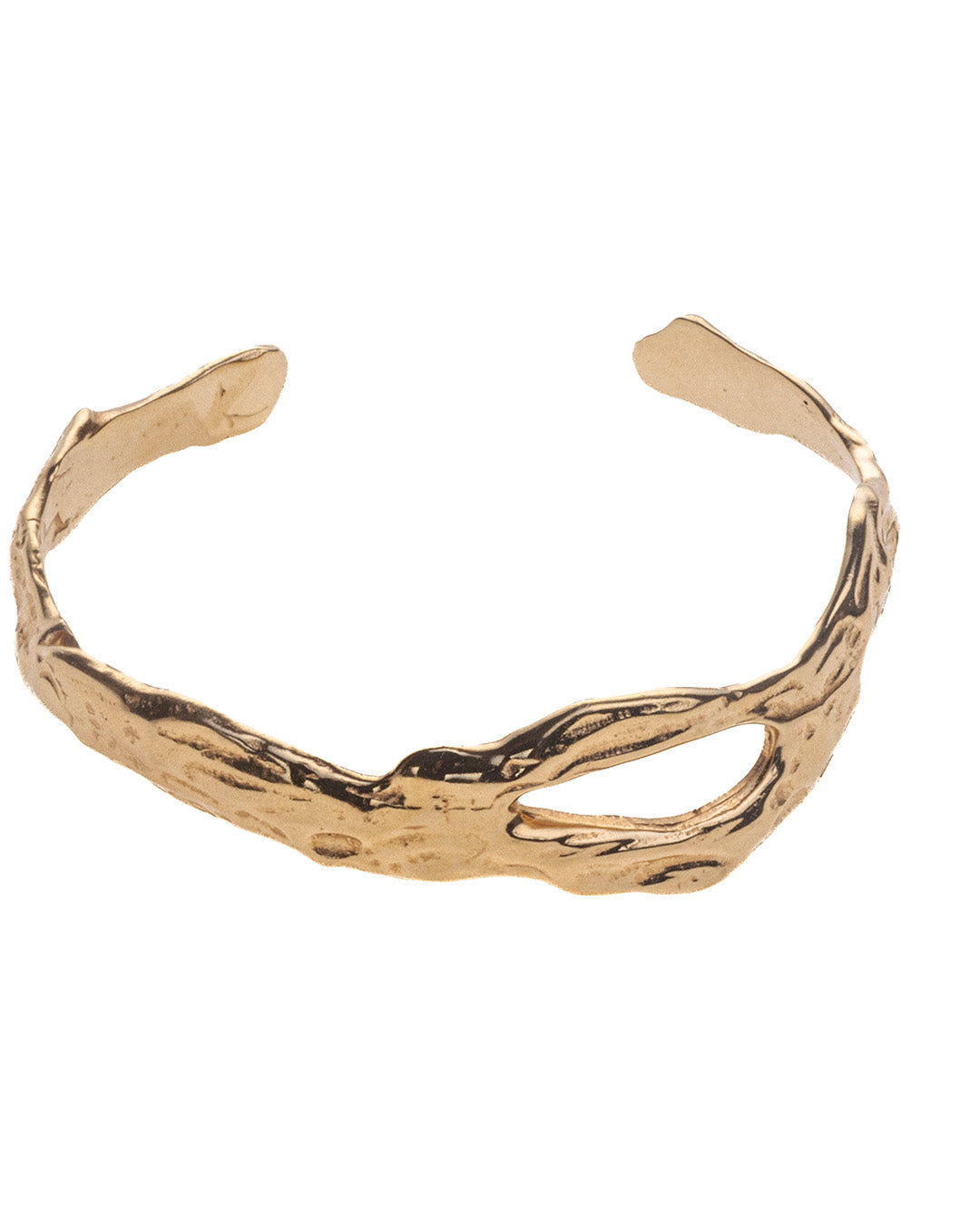 Bracelete Internos